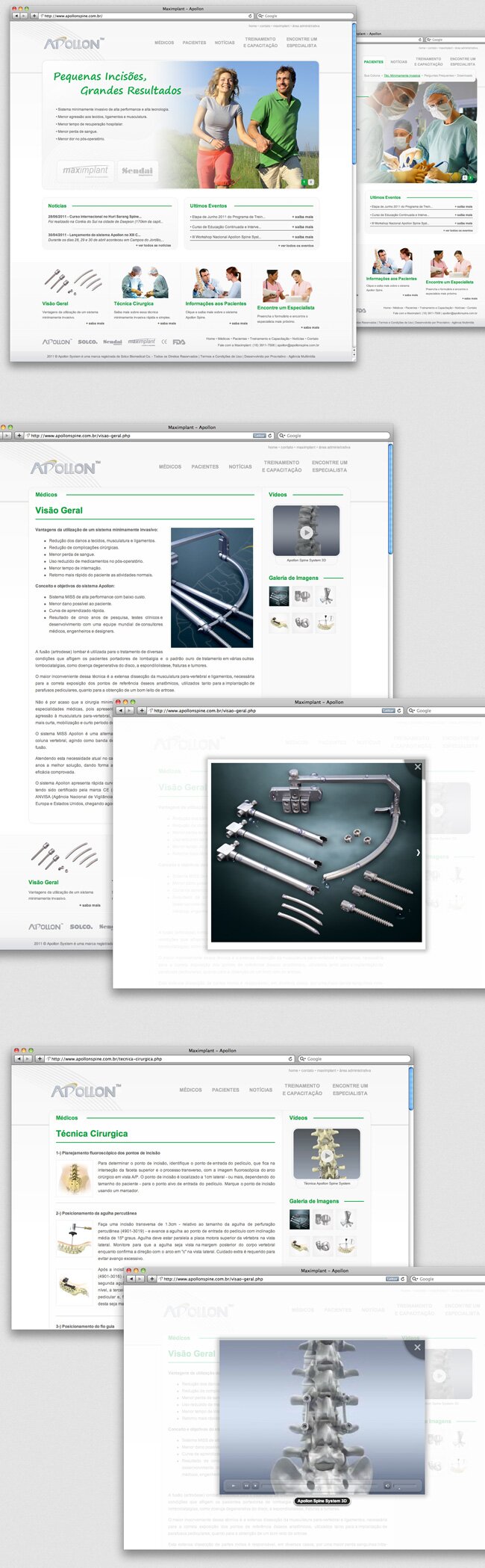Site Apollon Spine - Maximplant site-apollonspine.jpg